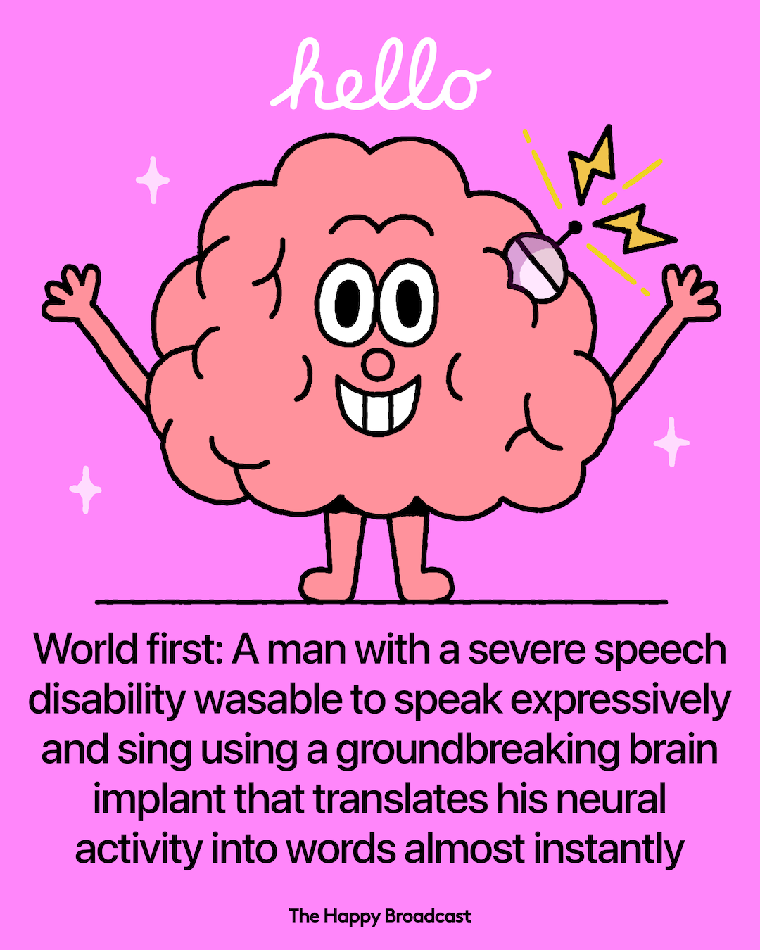 Brain Implant Enables Man With ALS to Speak Clearly and Sing